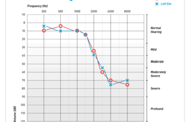Understanding Your Hearing Assessment: The Pure-Tone Air Conduction Test