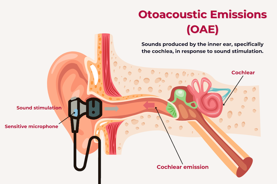 Otoacoustic Emissions (OAEs)