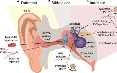 Acoustic Reflex Testing