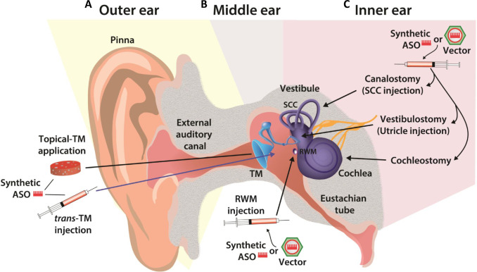 Acoustic reflex testing