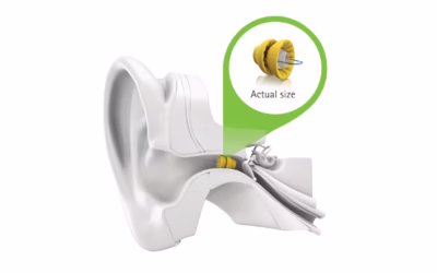 Phonak Lyric invisible hearing aid